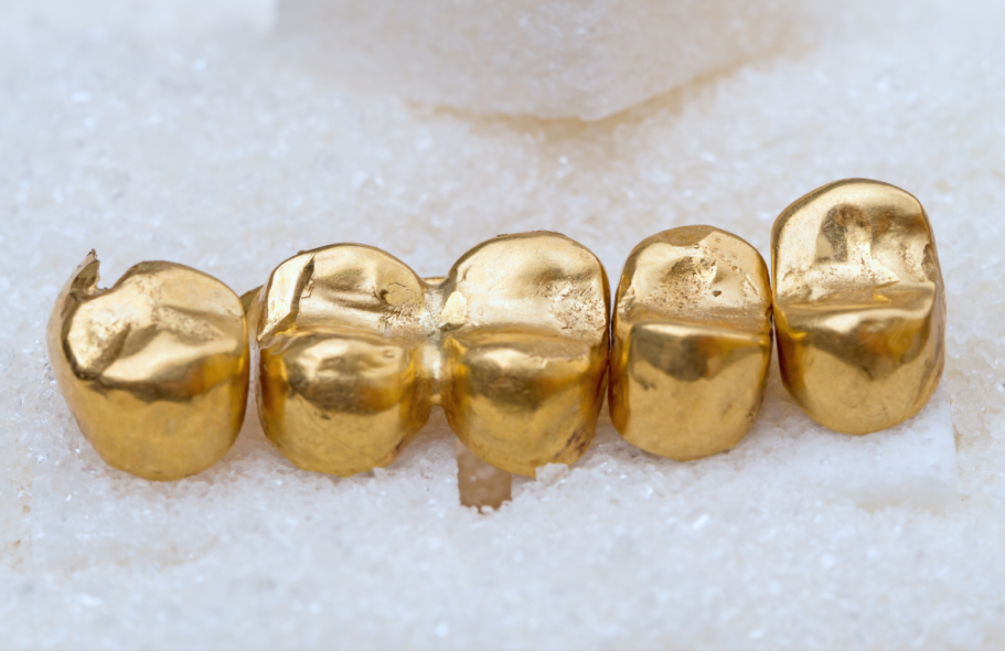 Ankauf von Zahngold, Altgold und Bruchgold in Denia, Costa Blanca